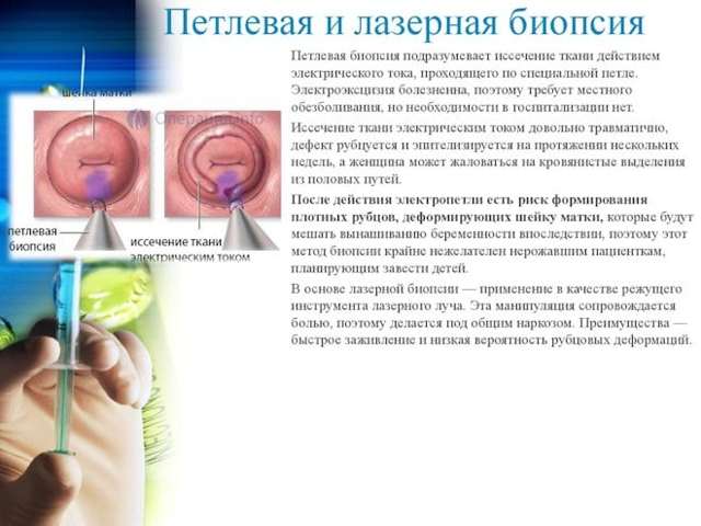 Анализы при эрозии шейки матки