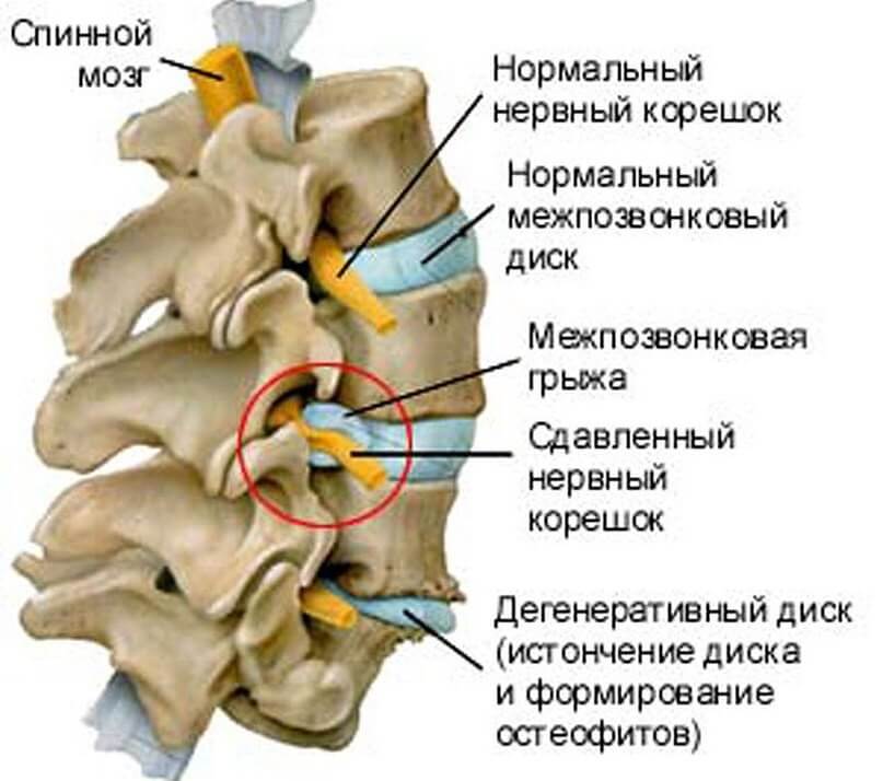 Лечение боли в пояснице в Киеве