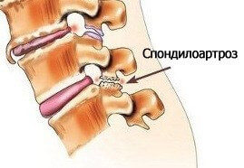 Лечение боли в пояснице в Киеве