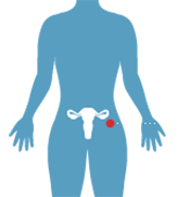 Гинекология