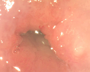 первичный вид