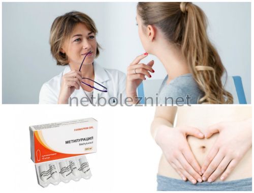 Использование свечей в гинекологии