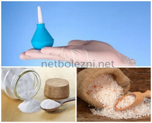 Спринцевание содой и солью