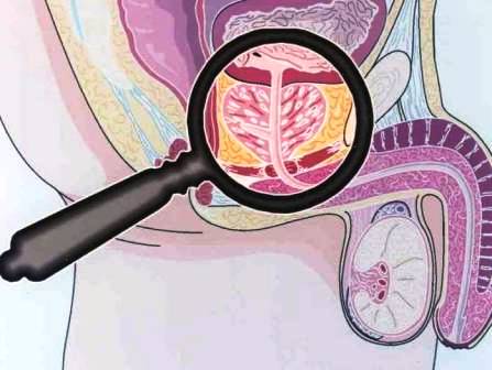 уреплазма и эрозия