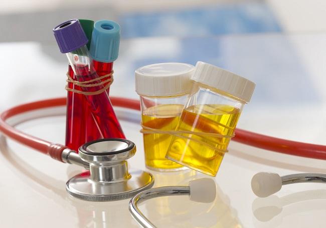 моча и кровь