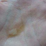 Коричневатые выделения