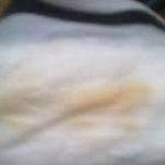 Розоватые выделения