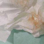 Розовые слизистые выделения