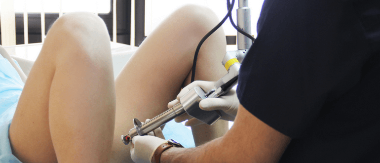 Как прижигают эрозию шейки матки: методики, преимущества, недостатки