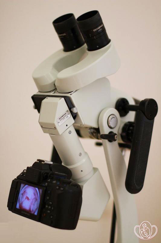 железистая псевдоэрозия шейки фото